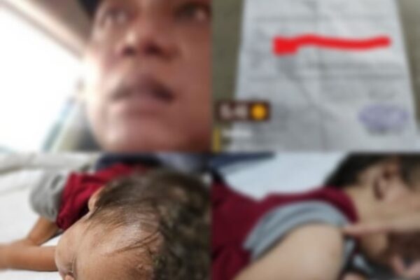 Viral.!! Anggreini Berjuang Sendiri Obati Anak diduga Derita Tumor dan Penyakit Kulit, Ayah Biologis Didesak Tanggungjawab